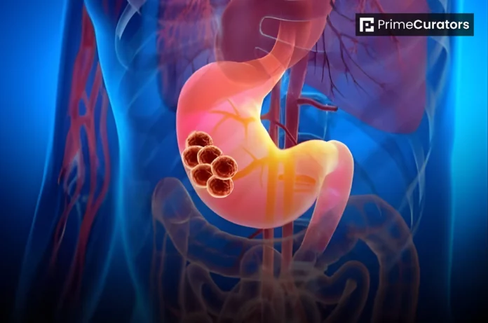 The Influenza Flu Virus is Being Used to Cure Pancreatic Cancer